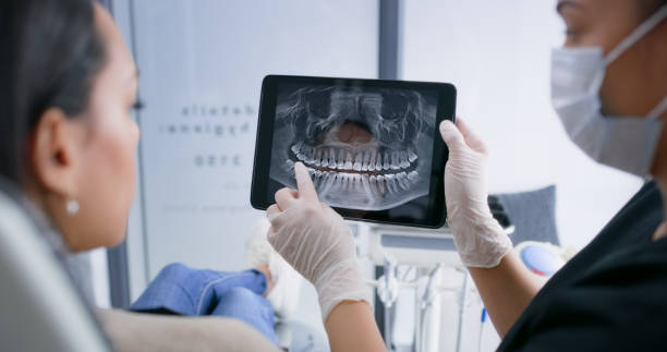 Licensed Tooth Extraction service in San Rafael, CA - Smile Center Dentistry